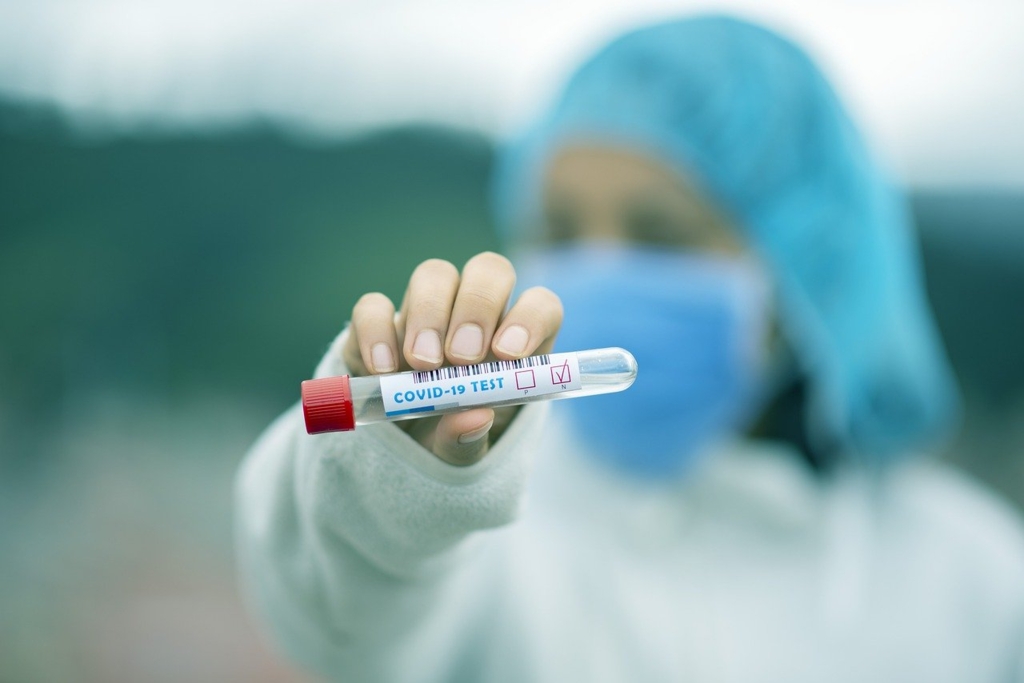 Care este pretul unui test antigen in Romania dar si in alte state