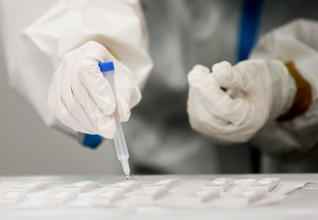 Cercetătorii au descoperit testul care arată cum va evolua infecţia cu SARS-CoV-2. Acesta poate uşura trierea pacienţilor