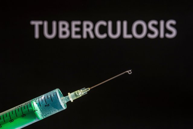 Noi achiziţii centralizate pentru medicamente necesare pacienţilor cu tuberculoză