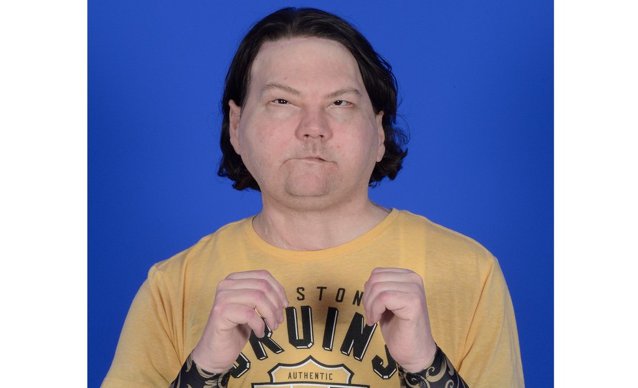 Un american a suferit o operaţie de transplant de faţă şi mâini