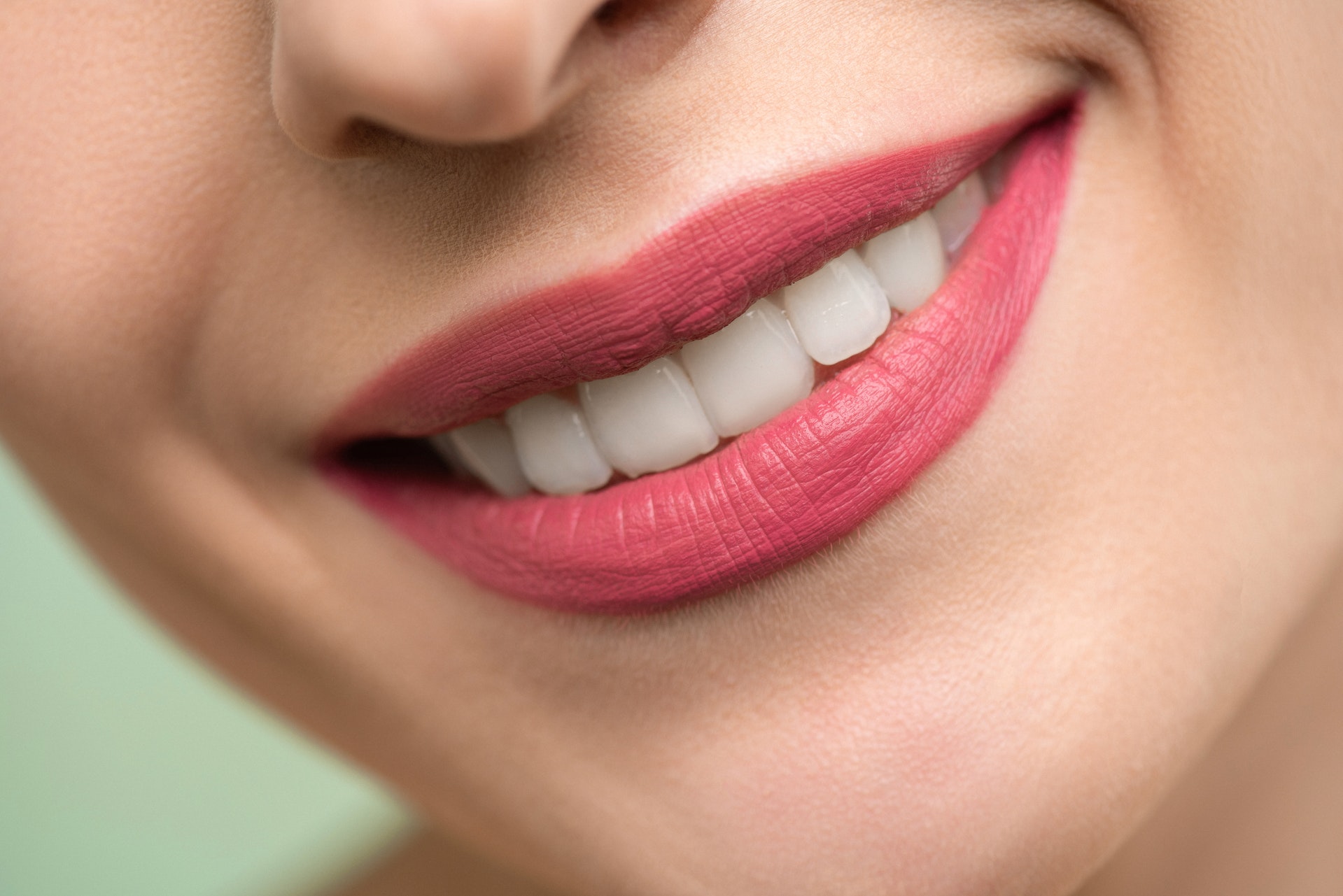 Zâmbetul ideal cu ajutorul fațetelor dentare?