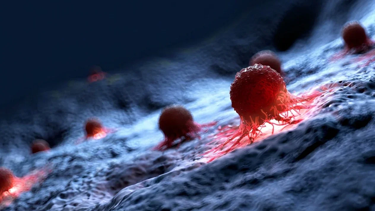 tratament cancer